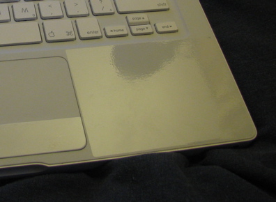 macbook shield wrist closeup